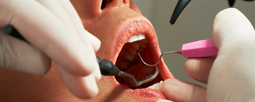 Dentisterie esthétique