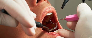 Dentisterie esthétique
