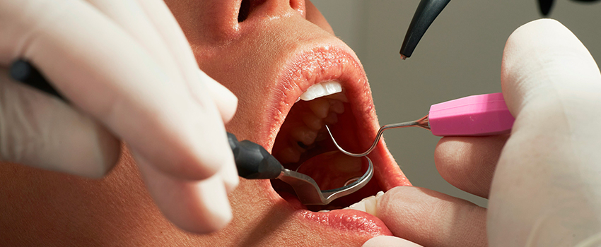Dentisterie esthétique